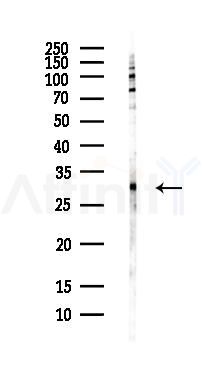 MMP7 Antibody - Western blot analysis of lysates from PC12 cells(LPS, 4h treatment), using MMP7 Antibody at 1/1000 dilution.