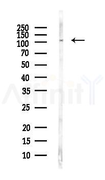 Integrin alpha4 Antibody - Western blot analysis of lysates from PC12 cells(LPS, 4h treatment), using Integrin alpha4 Antibody at 1/1000 dilution.