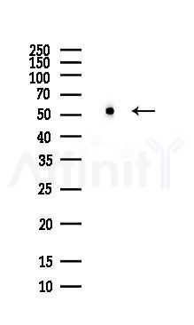 Desmin Antibody - Western blot analysis of lysates from PC12 cells(LPS, 4h treatment), using Desmin Antibody at 1/1000 dilution.