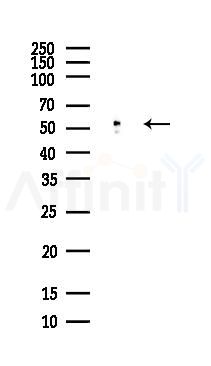Desmin Antibody - Western blot analysis of lysates from COLO205 cells(heat-shock,45min treatment), using Desmin Antibody at 1/1000 dilution.