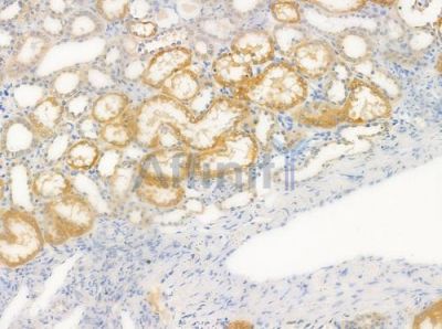 PRKAR1A Antibody - DF6142 at 1/100 staining human normal kidney tissue by IHC-P.