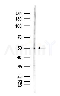Parkin Antibody - Western blot analysis of lysates from HepG2 cells(heat-shock,45min treatment), using Parkin Antibody at 1/1000 dilution.