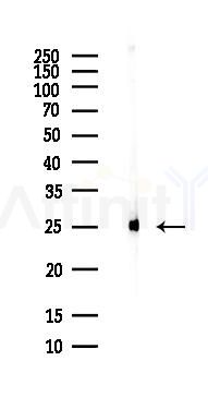 RAN Antibody - Western blot analysis of lysates from PC12 cells(LPS, 4h treatment), using RAN Antibody at 1/1000 dilution.