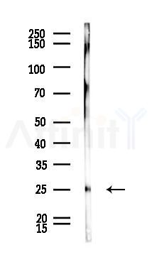 RAN Antibody - Western blot analysis of lysates from Rat liver, using RAN Antibody at 1/1000 dilution.