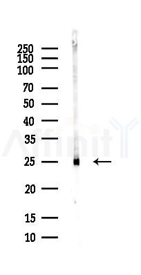 RAN Antibody - Western blot analysis of lysates from COLO205 cells(heat-shock,45min treatment), using RAN Antibody at 1/1000 dilution.