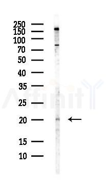ARF6 Antibody - Western blot analysis of lysates from COLO205 cells(heat-shock,45min treatment), using ARF6 Antibody at 1/1000 dilution.