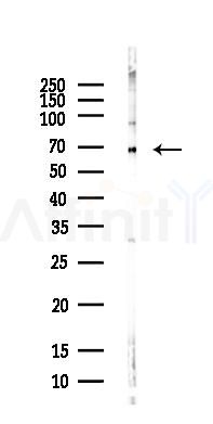 RPA1 Antibody - Western blot analysis of lysates from Rat liver, using RPA1 Antibody at 1/1000 dilution.