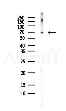 RPA1 Antibody - Western blot analysis of lysates from COLO205 cells(heat-shock,45min treatment), using RPA1 Antibody at 1/1000 dilution.