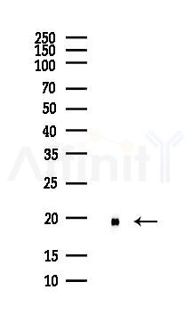 PPIA Antibody - Western blot analysis of lysates from COLO205 cells(heat-shock,45min treatment), using PPIA Antibody at 1/1000 dilution.