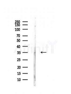 TPMT Antibody - Western blot analysis of lysates from Rat brain, using TPMT Antibody at 1/1000 dilution.