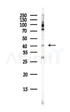 ADA Antibody - Western blot analysis of lysates from HepG2 cells(heat-shock, 45min treatment), using ADA Antibody at 1/1000 dilution.