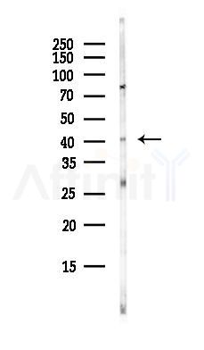 ADA Antibody - Western blot analysis of lysates from HepG2 cells(starvation, 24h treatment), using ADA Antibody at 1/1000 dilution.