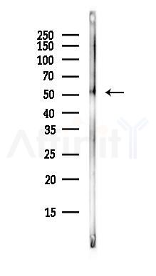 IRF4 Antibody - Western blot analysis of lysates from HepG2 cells(starvation, 24h treatment), using IRF4 Antibody at 1/1000 dilution.