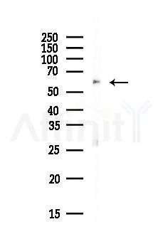 PPP3CA Antibody - Western blot analysis of lysates from Mouse brain, using PPP3CA Antibody at 1/1000 dilution.