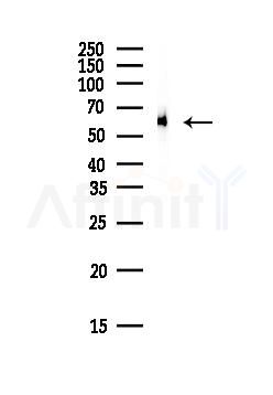 CALR Antibody - Western blot analysis of lysates from HepG2 cells(heat-shock, 45min treatment), using CALR Antibody at 1/1000 dilution.