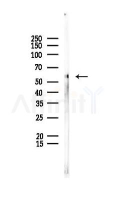 PDIA3 Antibody - Western blot analysis of lysates from Rat liver, using PDIA3 Antibody at 1/1000 dilution.