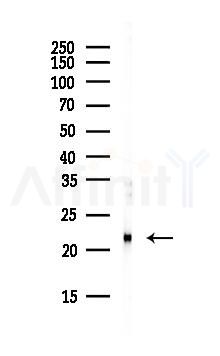 IL18 Antibody - Western blot analysis of lysates from HepG2 cells(starvation, 24h treatment), using IL18 Antibody at 1/1000 dilution.