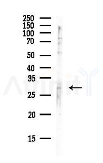 Emerin Antibody - Western blot analysis of lysates from Mouse brain, using Emerin Antibody at 1/1000 dilution.