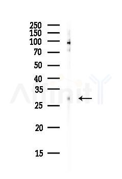 Emerin Antibody - Western blot analysis of lysates from HepG2 cells(heat-shock, 45min treatment), using Emerin Antibody at 1/1000 dilution.