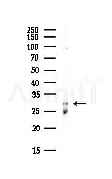 Emerin Antibody - Western blot analysis of lysates from HepG2 cells(starvation, 24h treatment), using Emerin Antibody at 1/1000 dilution.