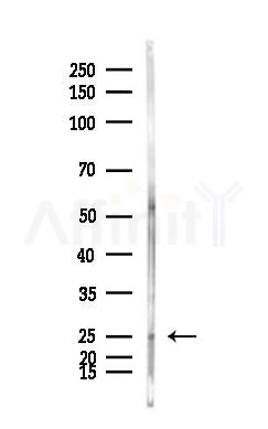 TNFRSF10C Antibody - Western blot analysis of lysates from HepG2 cells(heat-shock,45min treatment), using TNFRSF10C Antibody at 1/1000 dilution.