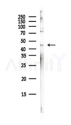 PHD2 Antibody - Western blot analysis of lysates from HepG2 cells(heat-shock, 45min treatment), using PHD2 Antibody at 1/1000 dilution.