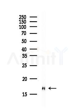 Profilin 1 Antibody - Western blot analysis of lysates from HepG2 cells(heat-shock, 45min treatment), using Profilin 1 Antibody at 1/1000 dilution.
