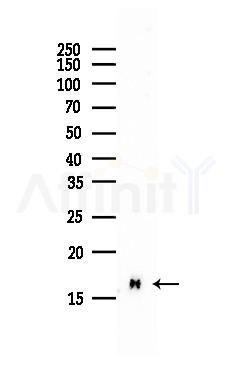 Profilin 1 Antibody - Western blot analysis of lysates from HepG2 cells(starvation, 24h treatment), using Profilin 1 Antibody at 1/1000 dilution.