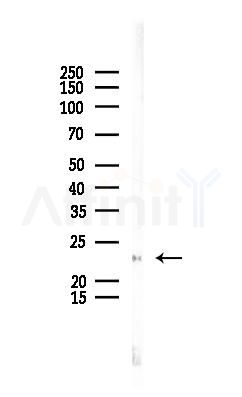 TMS1/ASC Antibody - Western blot analysis of lysates from Rat liver, using TMS1/ASC Antibody at 1/1000 dilution.