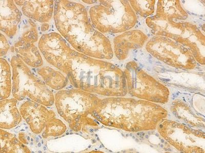 PDGFB Antibody - DF6328 at 1/100 staining human normal kidney tissue by IHC-P.