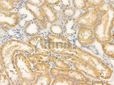 PDGFB Antibody - DF6328 at 1/100 staining human normal kidney tissue by IHC-P.