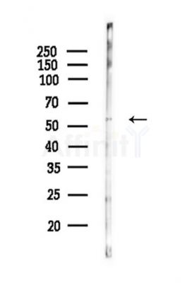 UGDH Antibody - Western blot analysis of lysates from HepG2 cells(starvation,24h treatment), using UGDH Antibody at 1/1000 dilution.