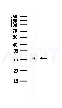 ARHGDIA Antibody - Western blot analysis of lysates from PC12 cells(LPS, 4h treatment), using ARHGDIA Antibody at 1/1000 dilution.