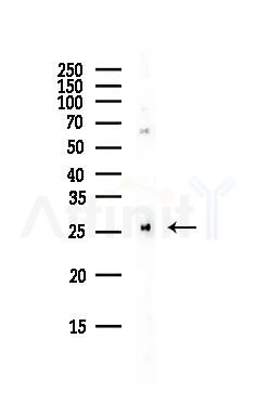 ARHGDIA Antibody - Western blot analysis of lysates from Rat lung, using ARHGDIA Antibody at 1/1000 dilution.