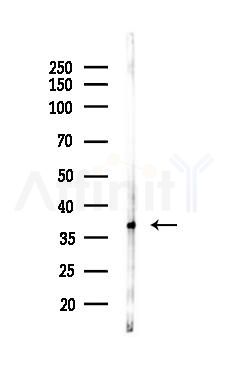 Glycophorin C/GPC Antibody - Western blot analysis of lysates from K562 cells(uv30min treatment), using Glycophorin C/GPC Antibody at 1/1000 dilution.