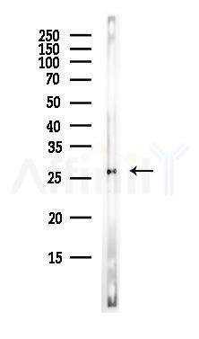 APRIL/TNFSF13 Antibody - Western blot analysis of lysates from MCF7 cells(heat-shock,45min treatment), using APRIL/TNFSF13 Antibody at 1/1000 dilution.