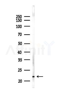 CGA Antibody - Western blot analysis of lysates from EC304 cells(UV,30min treatment), using CGA Antibody at 1/1000 dilution.