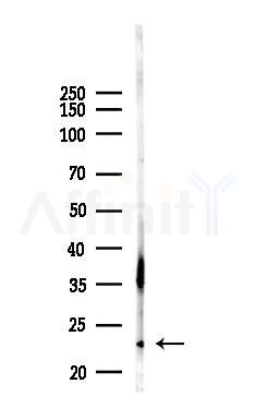 CGA Antibody - Western blot analysis of lysates from B16F10-LUC cells(UV,30min treatment), using CGA Antibody at 1/1000 dilution.