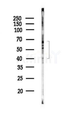 Ataxin 3 Antibody - Western blot analysis of lysates from HepG2 cells(starvation,24h treatment), using Ataxin 3 Antibody at 1/1000 dilution.