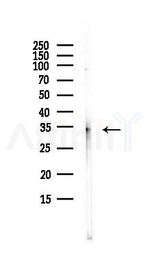Cyclin D1 Antibody - Western blot analysis of lysates from PC12 cells(LPS, 4h treatment), using Cyclin D1 Antibody at 1/1000 dilution.