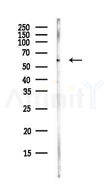 CBS Antibody - Western blot analysis of lysates from MCF7 cells(heat-shock,45min treatment), using CBS Antibody at 1/1000 dilution.