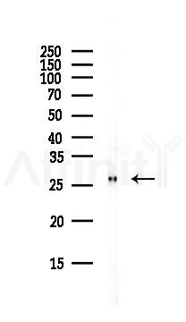 Carbonic anhydrase 2/CA2 Antibody - Western blot analysis of lysates from Rat lung, using Carbonic anhydrase 2/CA2 Antibody at 1/1000 dilution.