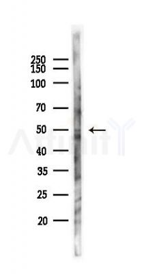 Factor X Antibody - Western blot analysis of lysates from 293 cells(UV,30min treatment), using Factor X Antibody at 1/1000 dilution.
