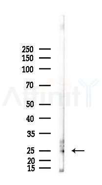 Galectin 3 Antibody - Western blot analysis of lysates from Hela cells(LPS, 4h treatment), using Galectin 3 Antibody at 1/1000 dilution.