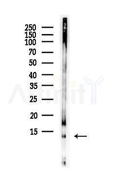 NPY Antibody - Western blot analysis of lysates from PC12 cells(LPS, 4h treatment), using NPY Antibody at 1/1000 dilution.