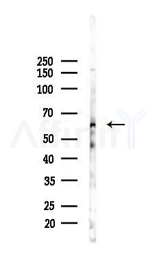 CES2 Antibody - Western blot analysis of lysates from Mouse testis, using CES2 Antibody at 1/1000 dilution.
