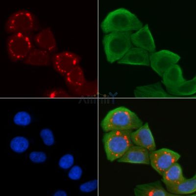 Collagen V  alpha 1 Antibody - DF6434 staining Hela cells(30min of UV treatment) by IF/ICC.