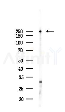 Collagen V  alpha 1 Antibody - Western blot analysis of lysates from Hela cells(heat-shock,45min treatment), using Collagen V  alpha 1 Antibody at 1/1000 dilution.