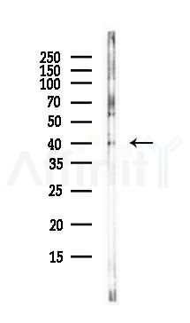 CDK9 Antibody - Western blot analysis of lysates from PC12 cells(LPS, 4h treatment), using CDK9 Antibody at 1/1000 dilution.