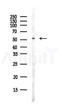 Tryptophan Hydroxylase Antibody - Western blot analysis of lysates from MCF7 cells(heat-shock,45min treatment), using Tryptophan Hydroxylase Antibody at 1/1000 dilution.